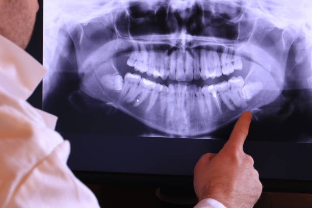 Best After-Hours Emergency Dentist in Canadian, TX