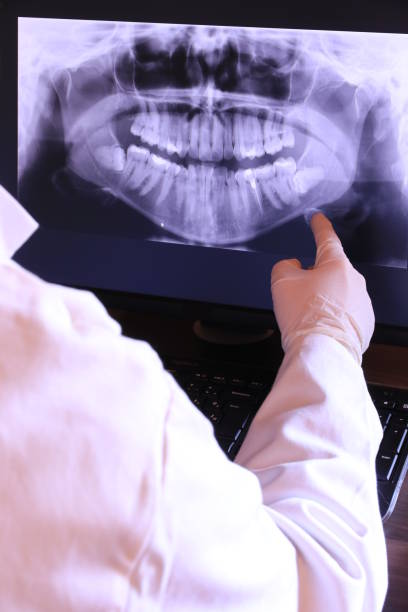 Best Emergency Root Canal Treatment in Canadian, TX